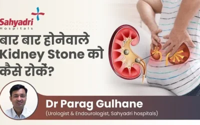 Beating Kidney Stones Again and Again: How to Stop the Cycle?
