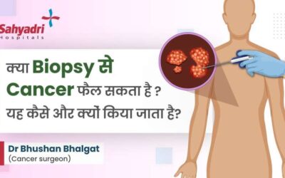 Can Biopsy Spread Cancer?